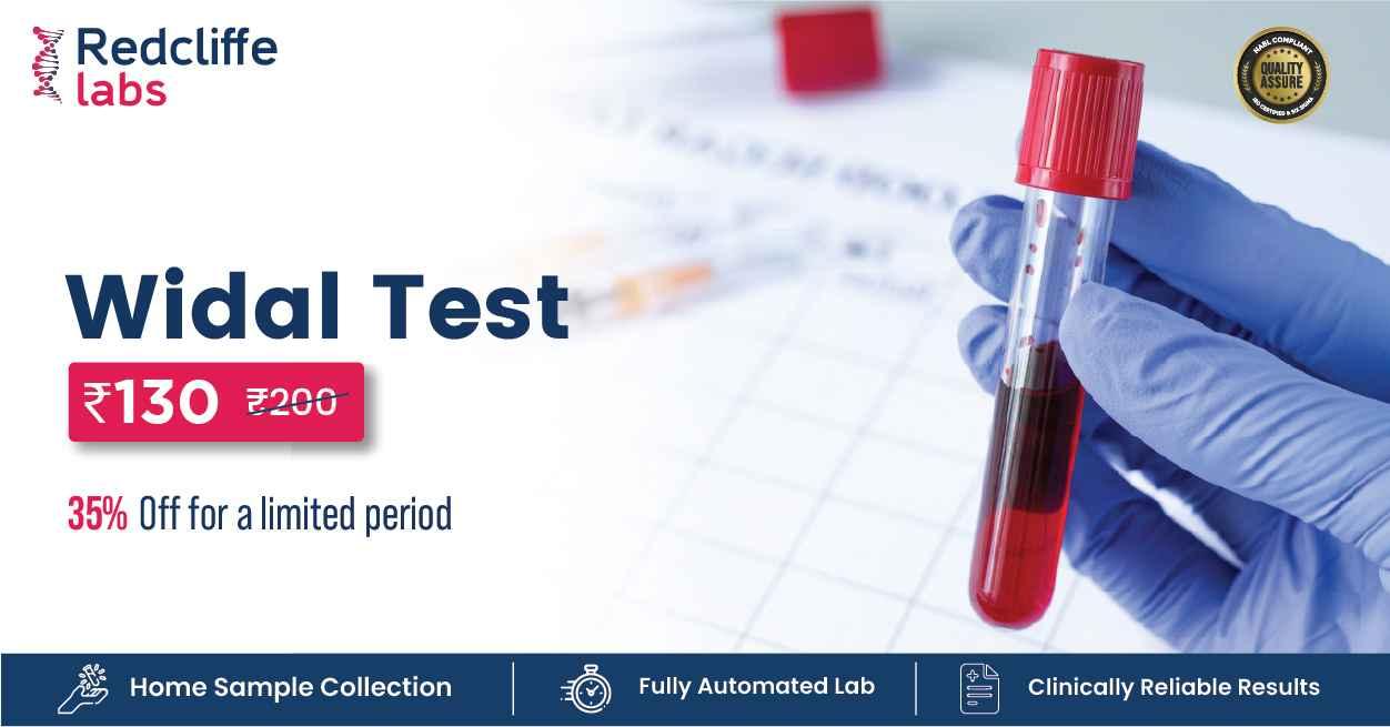 Widal Test in Bangalore