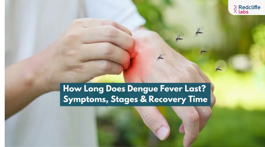 How Long Does Dengue Fever Last? Symptoms, Stages & Recovery Time