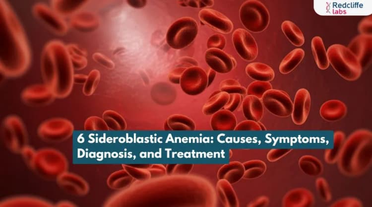 6 Sideroblastic Anemia: Causes, Symptoms, Diagnosis, and Treatment