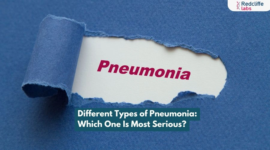 Different Types of Pneumonia: Which One Is Most Serious?