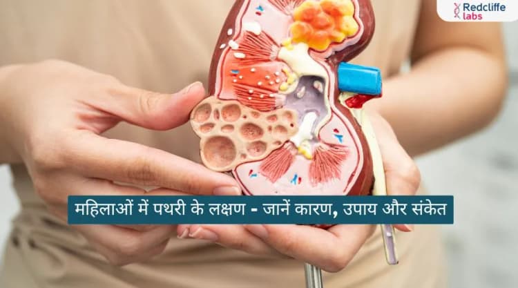 महिलाओं में पथरी के लक्षण- जानें कारण, उपाय और संकेत