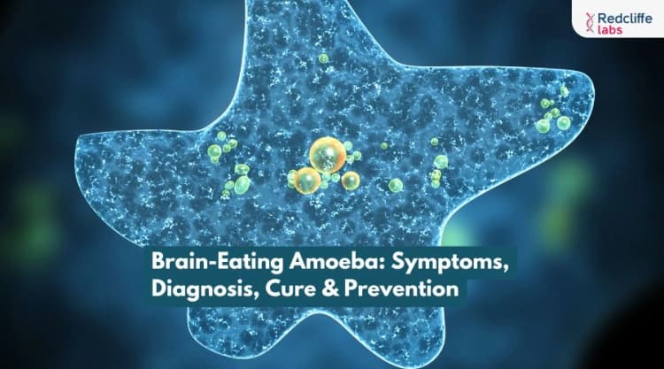 Brain-Eating Amoeba: Symptoms, Diagnosis, Cure & Prevention