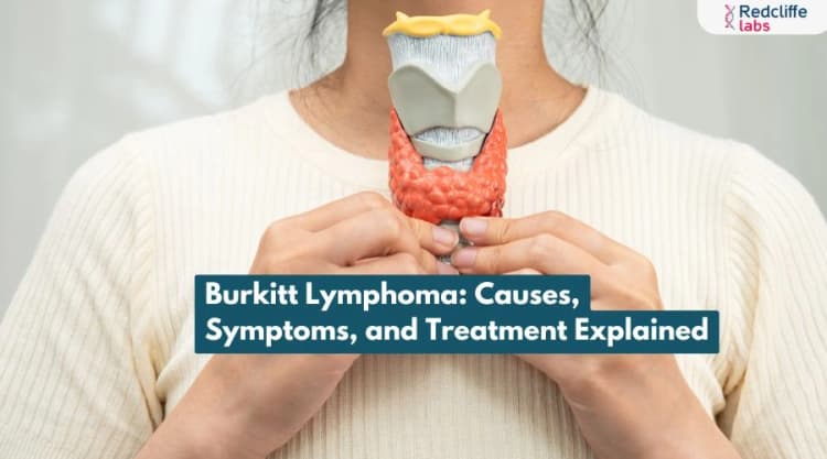 Burkitt Lymphoma: Causes, Symptoms, and Treatment Explained