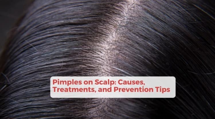 Pimples on Scalp: Causes, Treatments, and Prevention Tips
