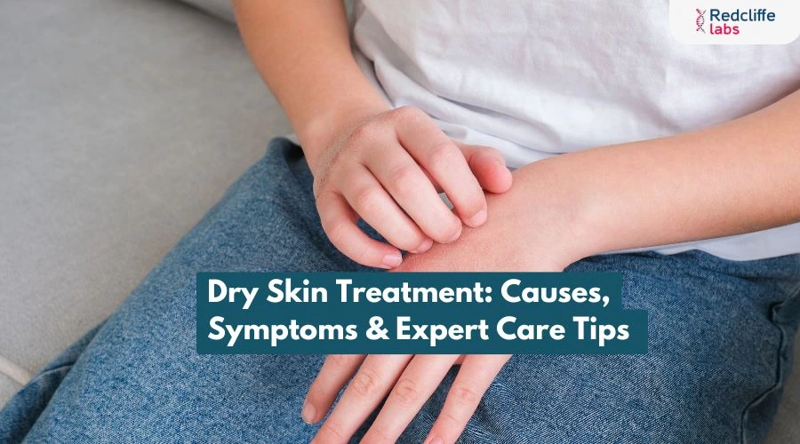 Dry Skin Treatment: Causes, Symptoms & Expert Care Tips
