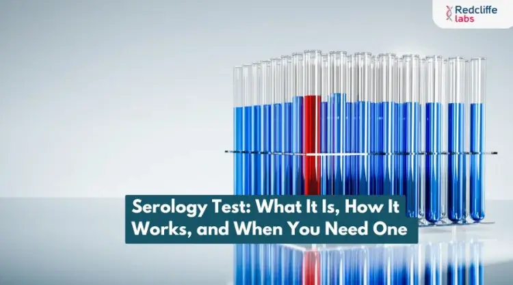 Serology Test: What It Is, How It Works, and When You Need One