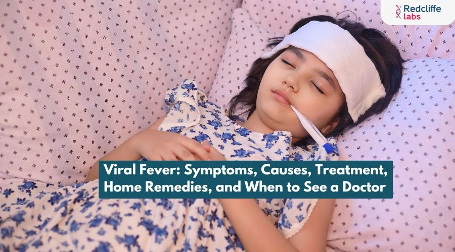 Viral Fever: Symptoms, Causes, Treatment, Home Remedies, and When to See a Doctor