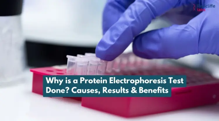 Why is a Protein Electrophoresis Test Done? Causes, Results & Benefits