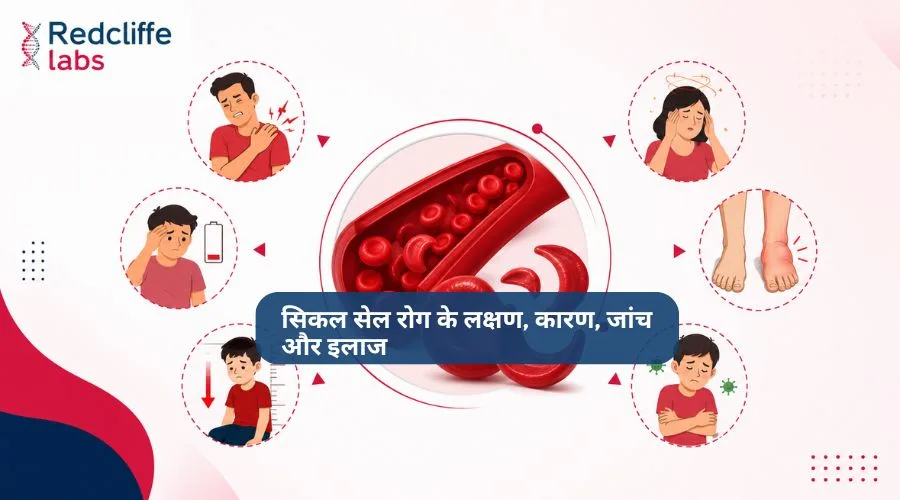 सिकल सेल रोग के लक्षण, कारण, जांच और इलाज
