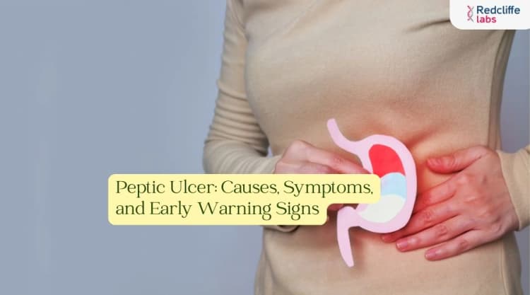 Peptic Ulcer: Causes, Symptoms, and Early Warning Signs