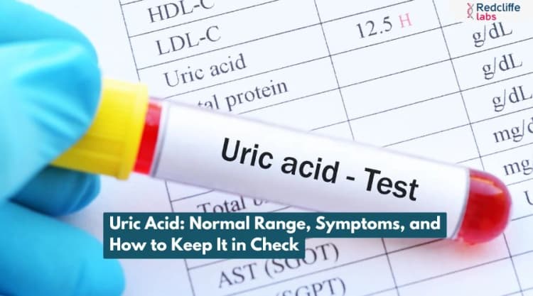 Uric Acid: Normal Range, Symptoms, and How to Keep It in Check