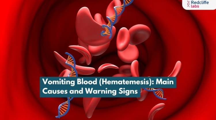 Vomiting Blood (Hematemesis): Main Causes and Warning Signs