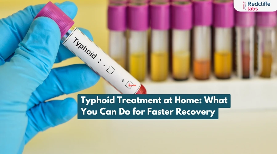 Typhoid Treatment at Home: What You Can Do for Faster Recovery