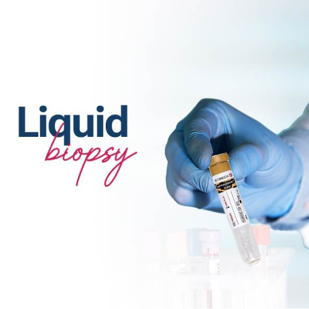 Liquid Biopsy