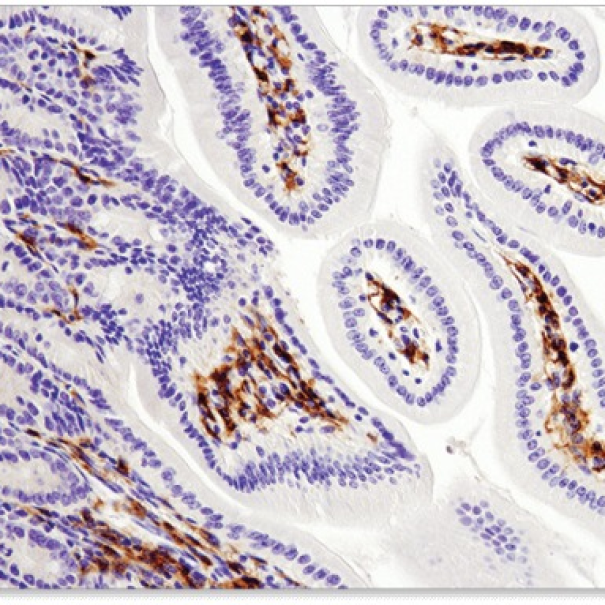 Immunohistochemistry (IHC)