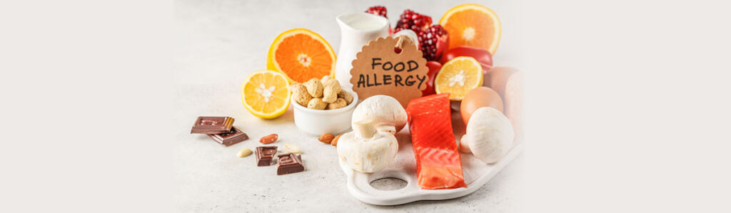 Allergy panel food