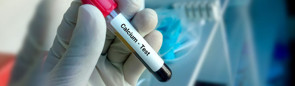 Calcium Test