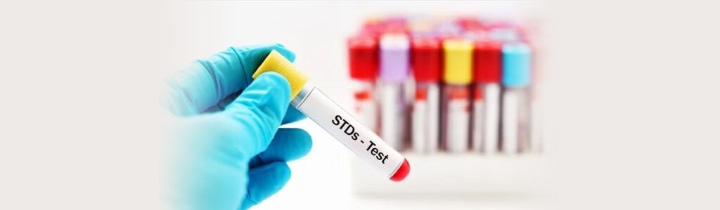 STD Testing