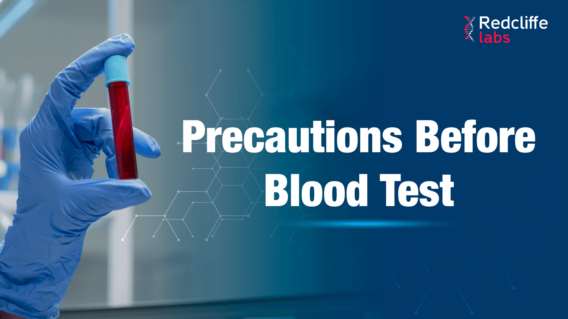 Precautions before blood test