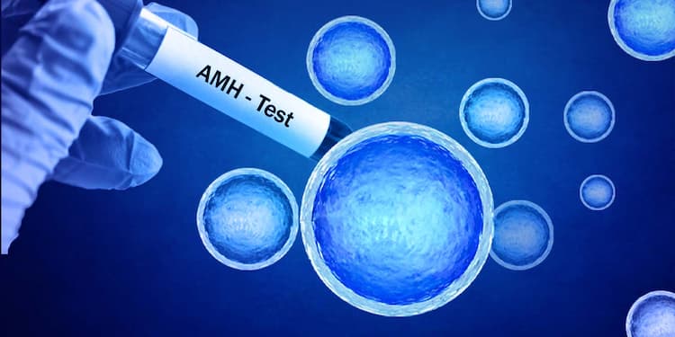 AMH Test - What is it, Full Form, its Cost & More