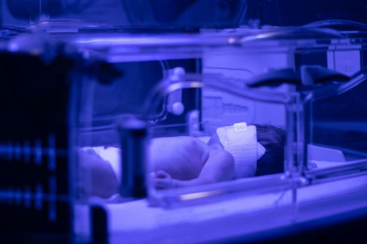 Bilirubin Level in Newborn Baby: Physiological vs Pathological Jaundice, Range and More