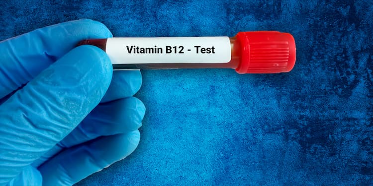 Vitamin B12 Test Guide: High, Low, and Normal Levels