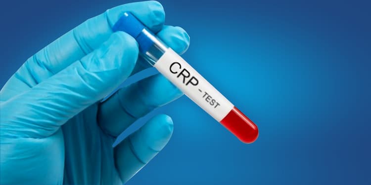 CRP test: What is CRP Test? What levels of CRP are dangerous?