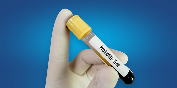 Prolactin Test: Price, High vs. Low Levels, Need, & More