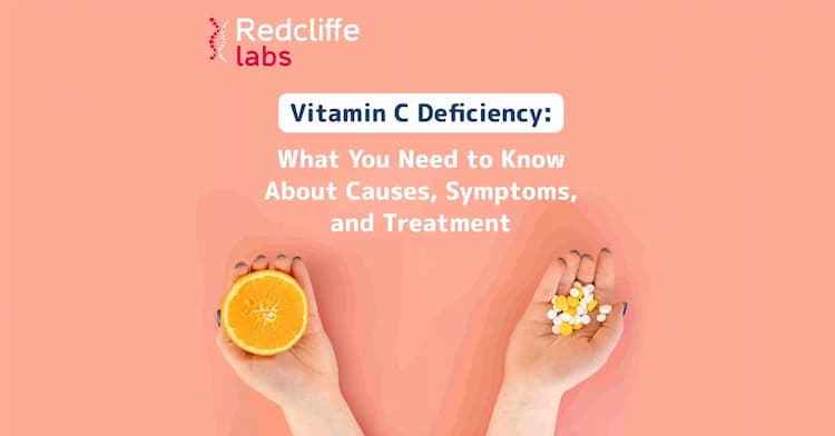 Vitamin C Deficiency: What You Need to Know About Causes, Symptoms, and Treatment