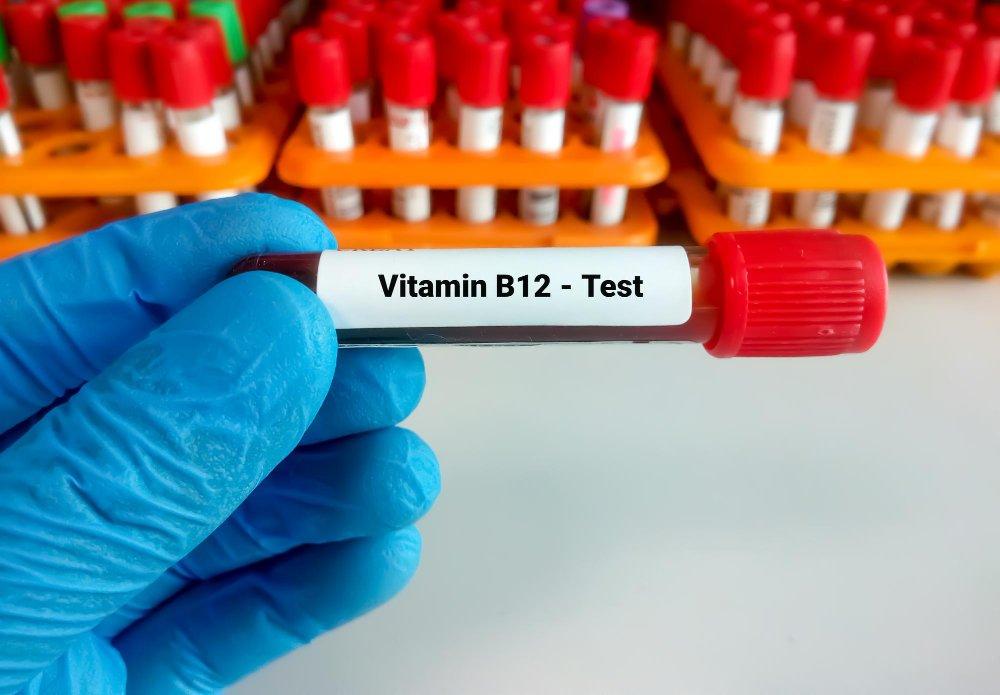 Vitamin B12 Test in Hindi