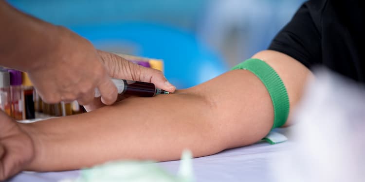 Fasting Before Blood Tests:  which tests require fasting,tips to get effective lab test results