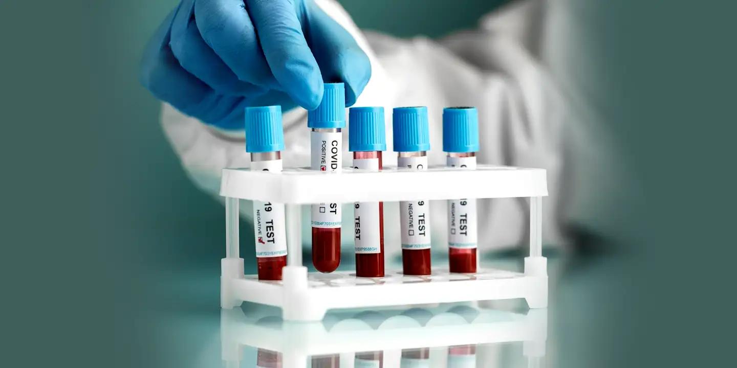 Blood Tests List What are they Definitions and Abbreviations, How to Book, Price in India