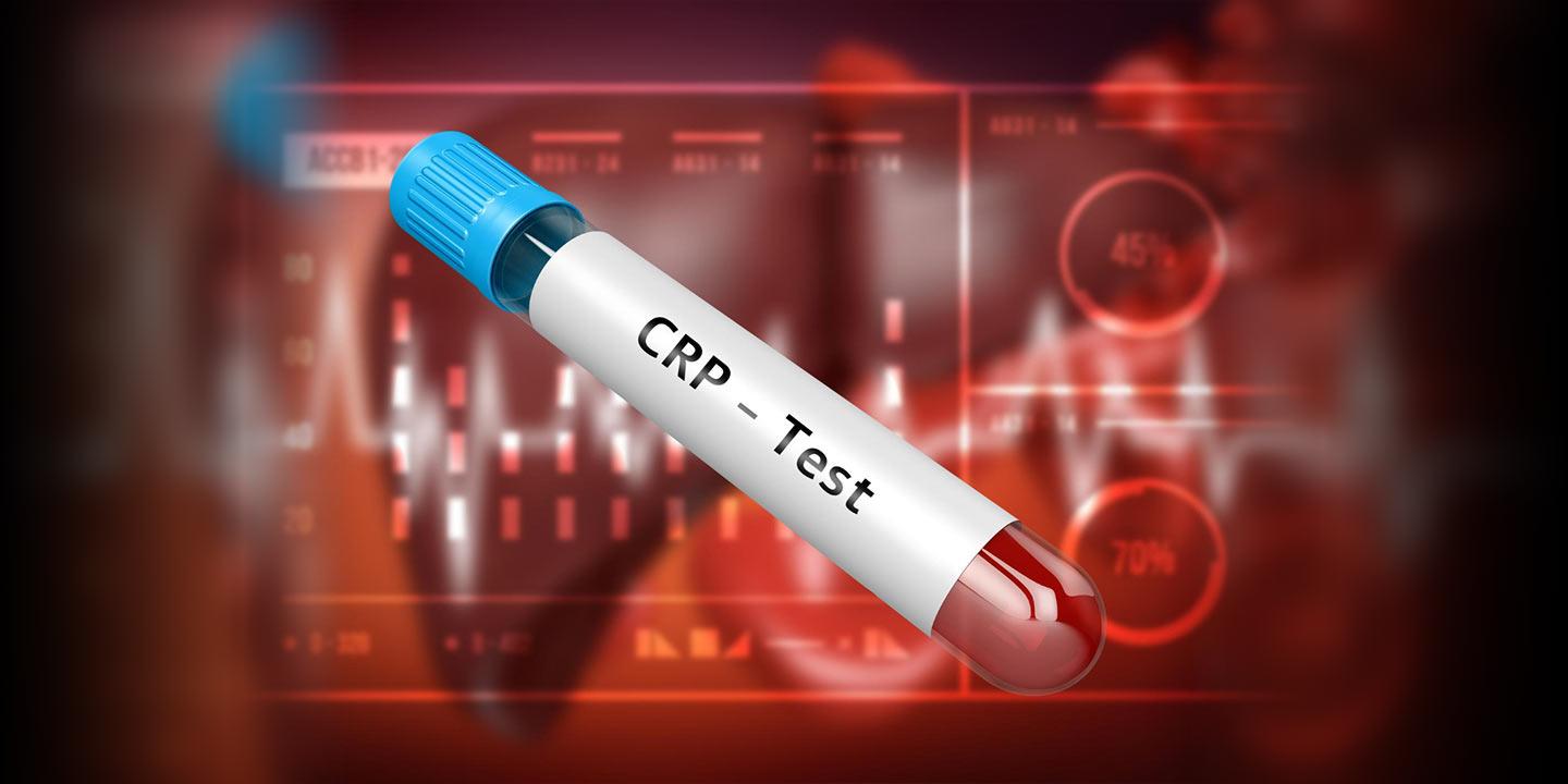 CRP-Normal-Range