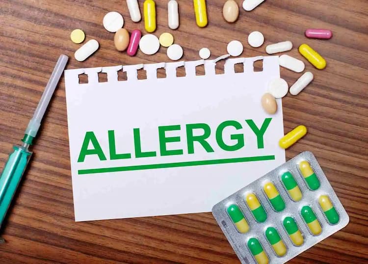 What are the Drug Allergy Symptoms and Treatment?