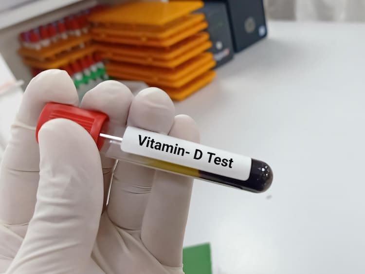 Vitamin D Test in Hindi - विटामिन डी टेस्ट कैसे, क्यों और कब कराये