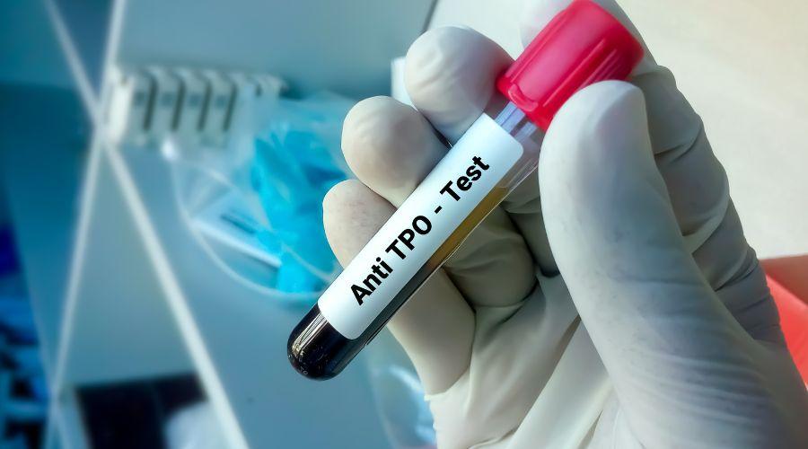 Anti TPO Test