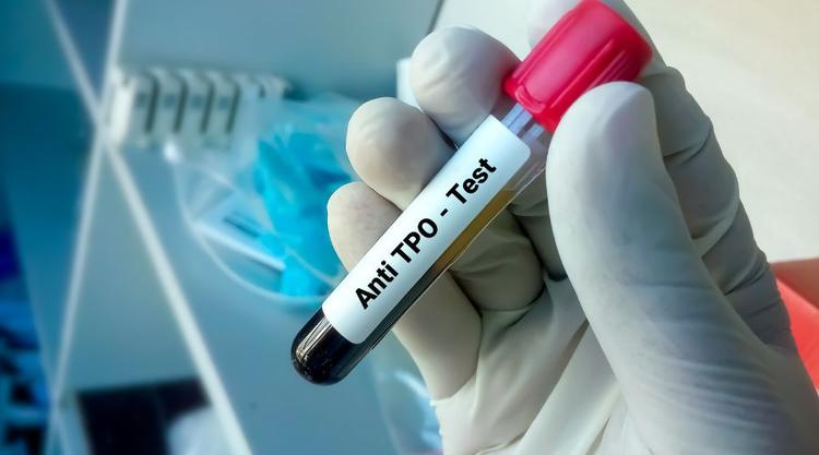 Anti TPO Test in Hindi: थायराइड समस्याओं की जांच और नियंत्रण