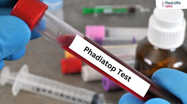 Phadiatop Test - Price, Purpose, Procedure, Results, & More