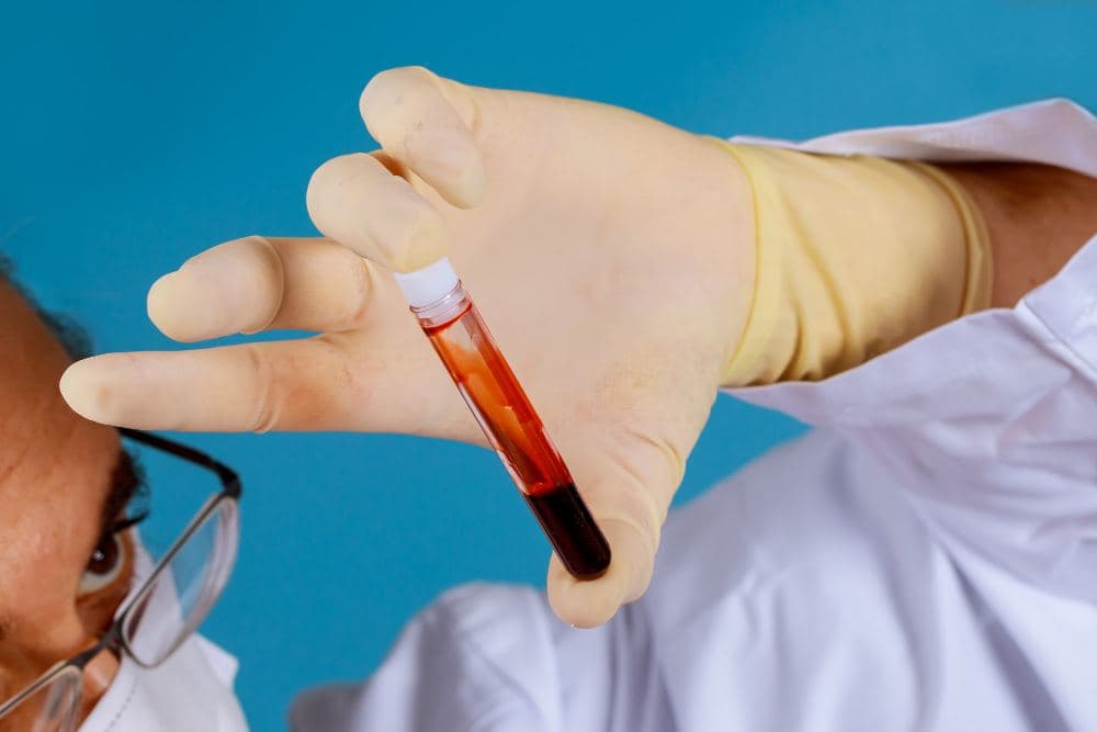 Blood Tests for Fever