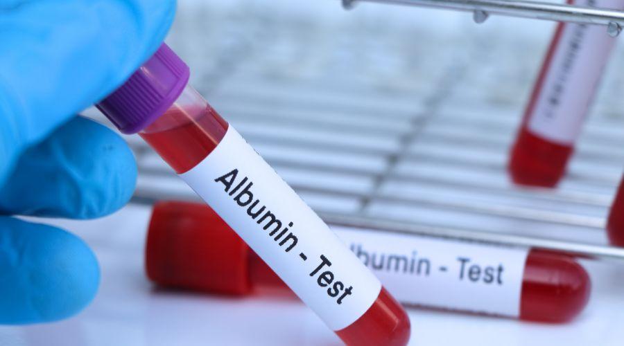 Albumin Test