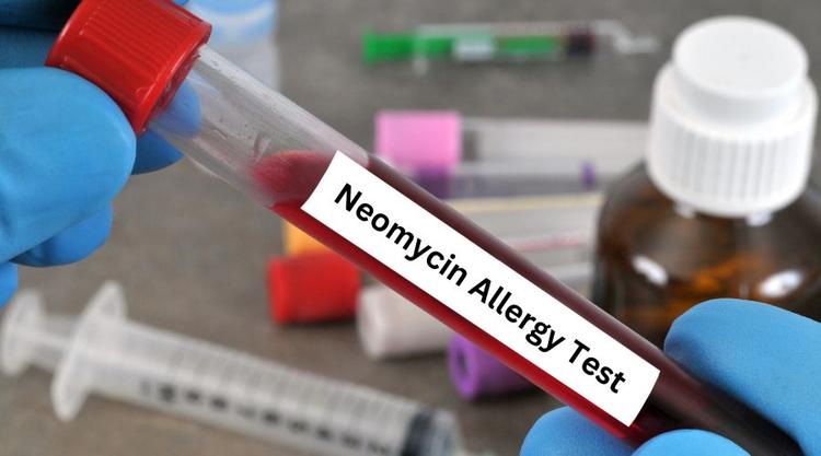 Neomycin Allergy Test: Symptoms, Preventions, & Treatment