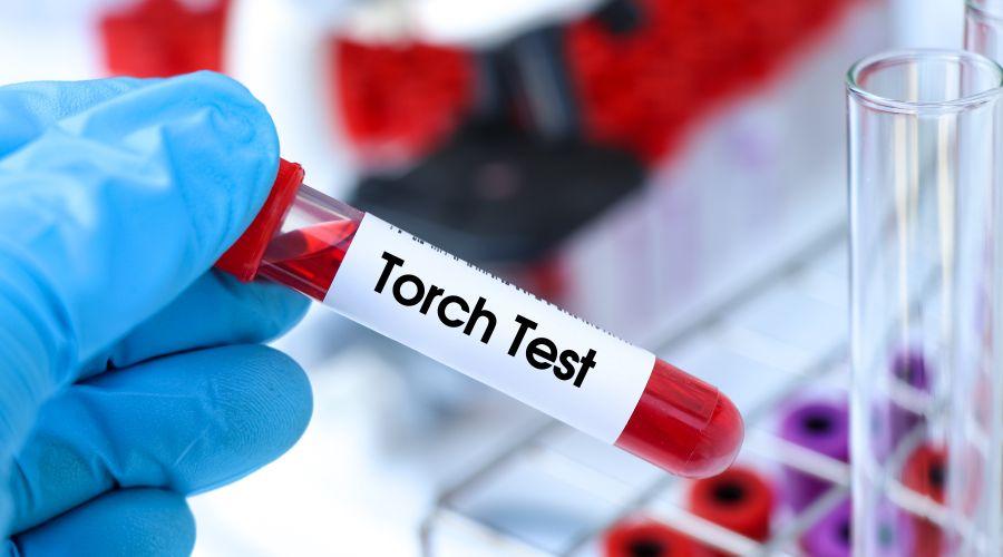 Torch Test in Hindi