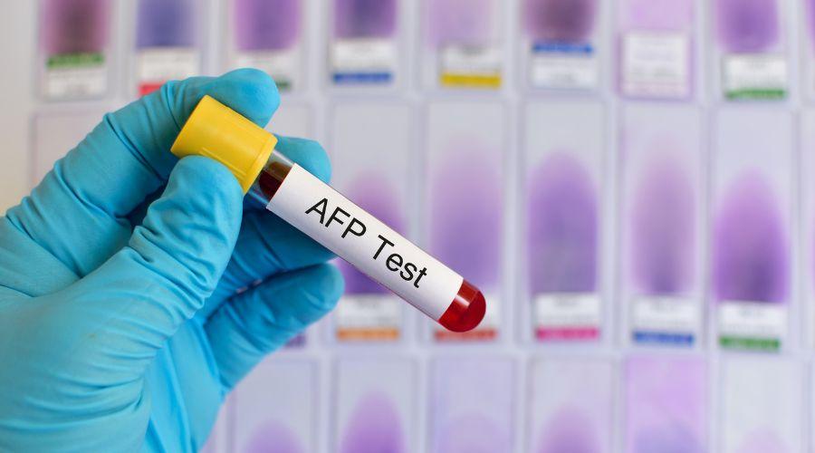 AFP Test