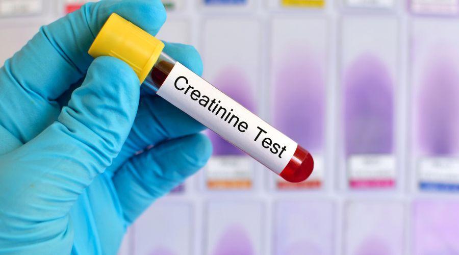 Creatinine test