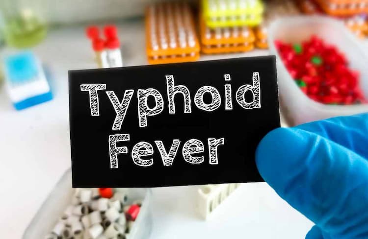 Typhoid in Hindi: टाइफाइड के लक्षण, रोकथाम, जोखिम, तथा इलाज