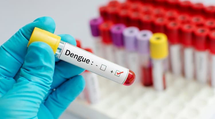 डेंग्यू लक्षणे: उपचार, कारण, आणि बचाव