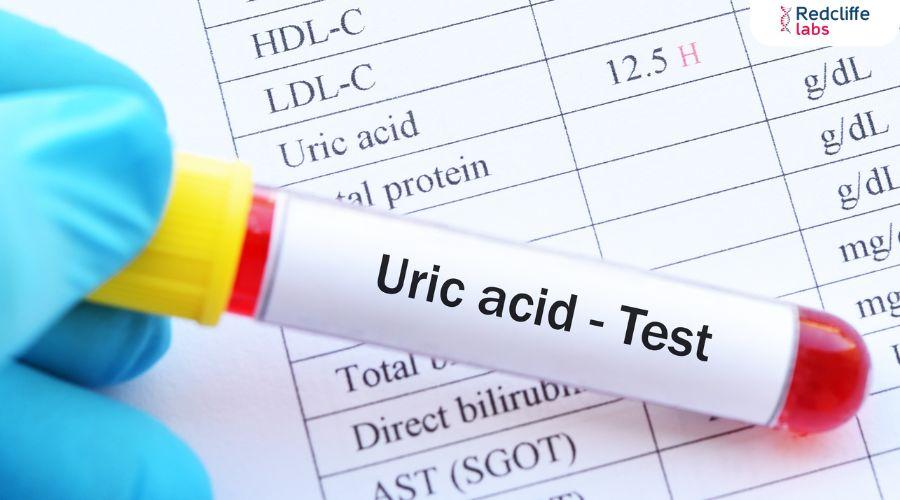 Uric acid test