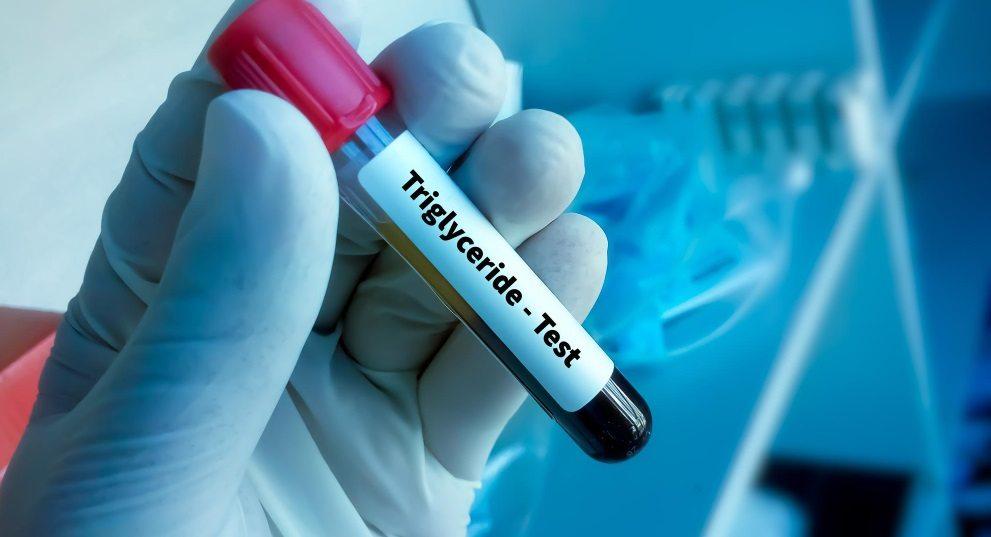 Triglycerides Meaning in Bengali: বাংলা ভাষায় বিস্তারিত ব্যাখ্যা