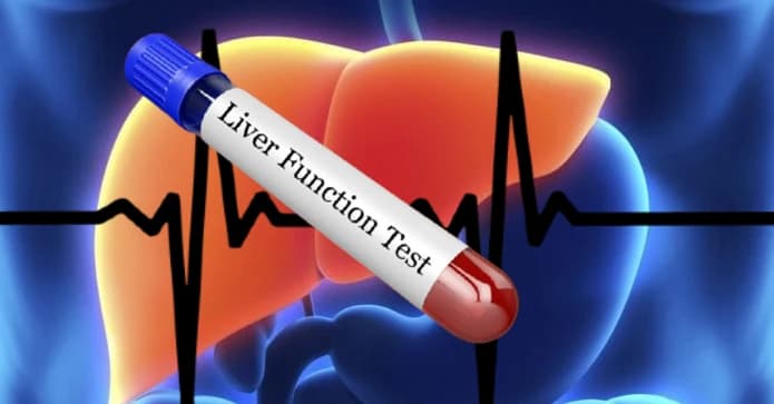 Overview of Liver Function Test