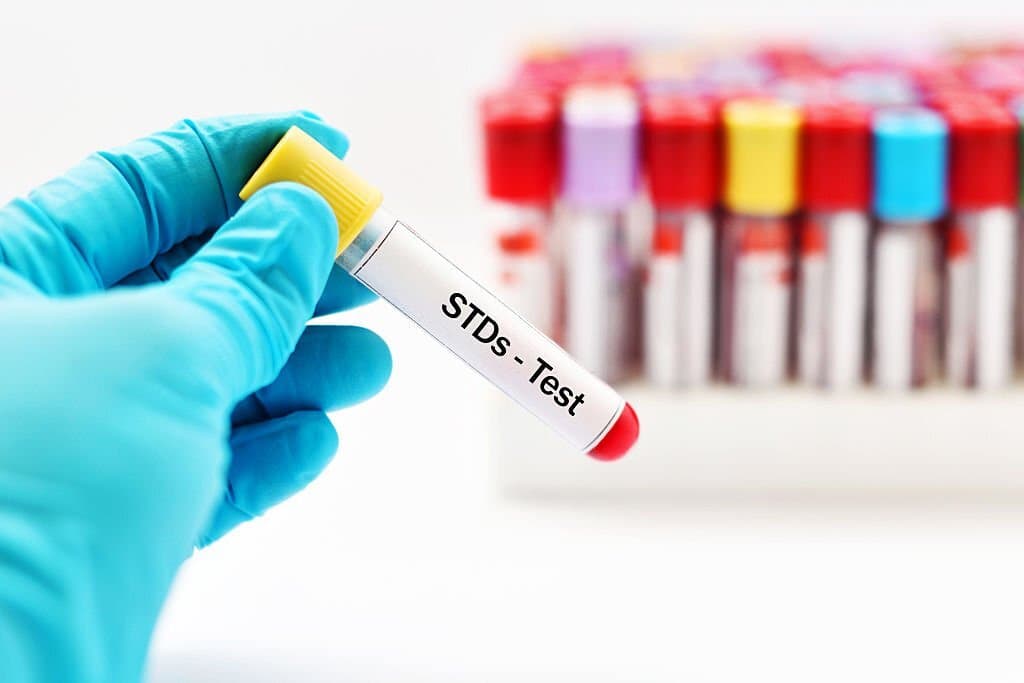 STDs - Test